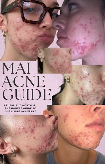 MAI ACNE GUIDE (DIGITAL FILE)